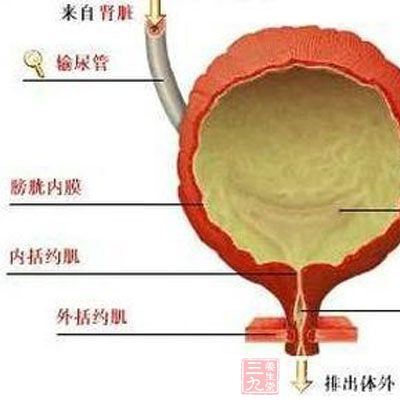 绝经期尿路感染的症状 了解绝经期尿路感染