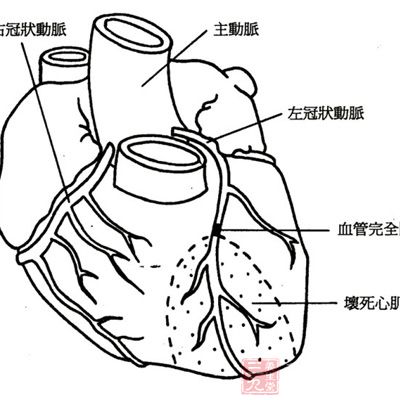 冠状动脉旁路移植术