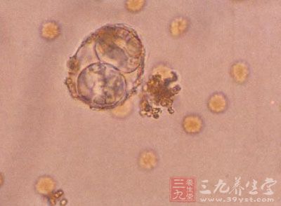 等孢球虫病