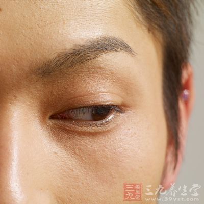 容易生成皺紋，尤以眼部及口部四周明顯