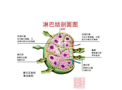 淋巴癌的症状