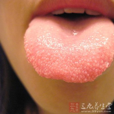 舌癌的早期症状 了解舌癌很重要