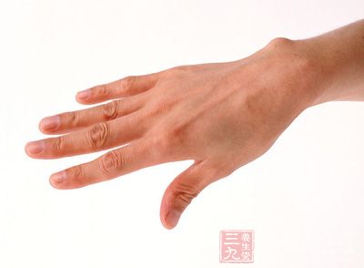 得了冻疮怎么办--三九养生堂专家专栏