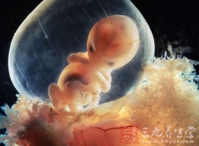 胎儿肾积水怎么办 专家教你治疗胎儿肾积水