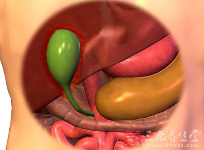 胆囊息肉的发病机制  是什么引起胆囊息肉