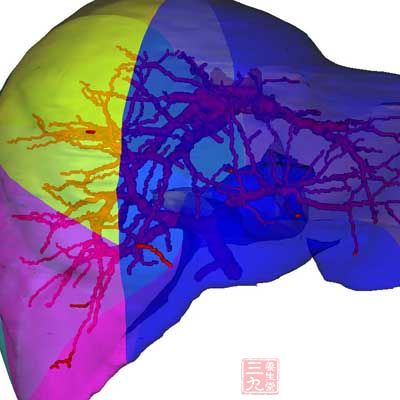 肝细胞癌，一般有肝炎、肝硬变病史