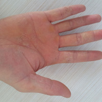 颚口线虫病--三九养生堂专家专栏