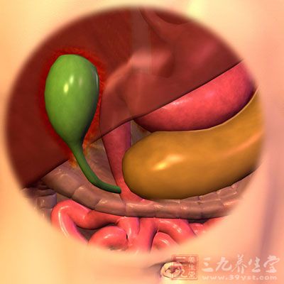 胆囊息肉的病因可能是因为胆汁分泌多