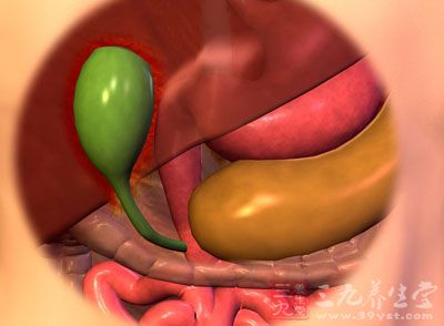 胆囊癌病因 “揪出”胆囊癌的元凶