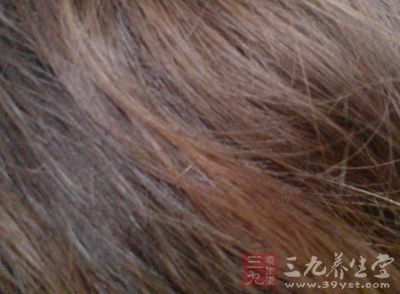 <em>洗头发掉</em>头发怎么办 帮你解决<em>掉发</em>烦恼