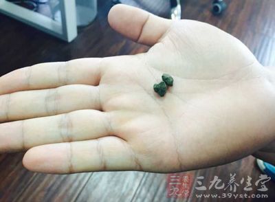 这肺部咳出“煤球”到底是怎么回事