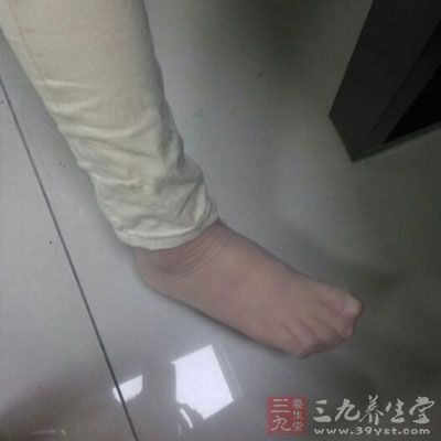 脚趾头的响声 脚趾头的响声