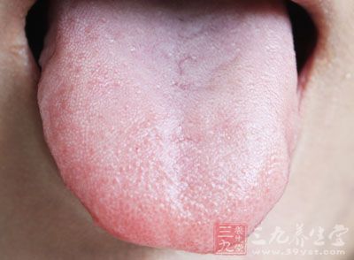 舌头是人体健康直接的反应之一