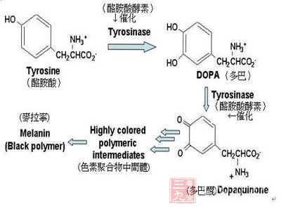 酪氨酸酶缺乏