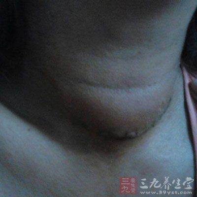 手术的主要并发症：