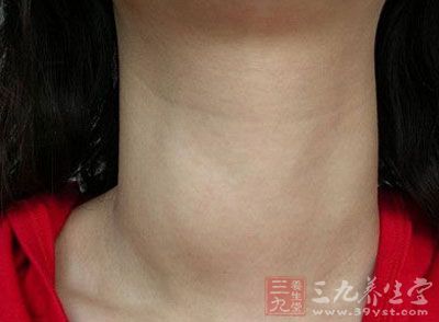甲状腺肿大有何危害