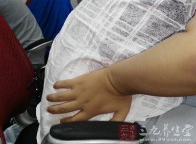 疼痛忍受度 疼痛忍受度