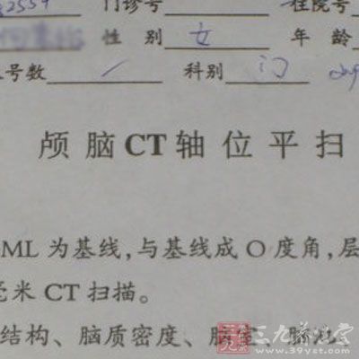 摔着后脑做CT