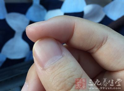 指甲方面的疾病,如灰指甲,如不注意将衣服分开清洗,也容易导致妇科病 指甲方面的疾病,如灰指甲,如不注意将衣服分开清洗,也容易导致妇科病