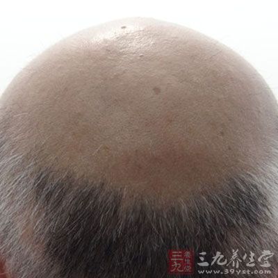 好的洗發(fā)護(hù)發(fā)用品，一星期一次的專業(yè)護(hù)理