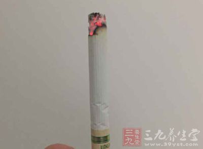 过度的抽烟也可以引发牛皮癣