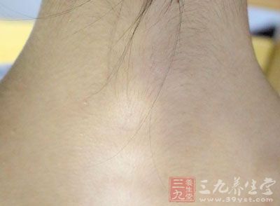 颈椎病诊断金口诀(二)