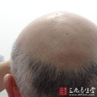 男性这里少毛竟是大病征兆