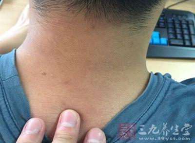 什么是甲状腺炎 什么是甲状腺炎