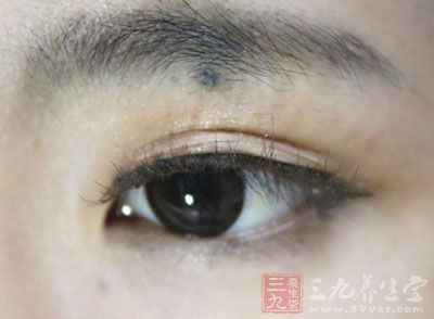 原发性共同性内斜视-三九养生堂养生百科