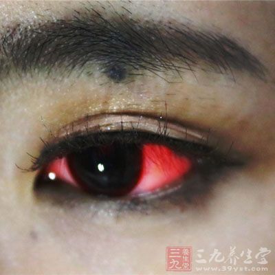 眼睛这症状可能是癌(3)