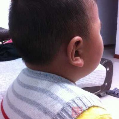 头发浓密的宝宝也可采取以上的护发方法