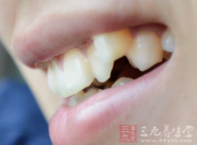 牙齿松动怎么治疗 让你恢复正常牙齿的方法