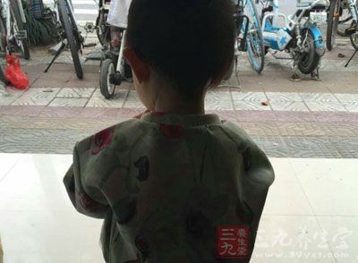 切忌穿得太多，宝宝捂坏