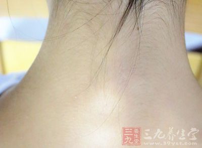 头用力向胸部低垂,然后向后仰伸 头用力向胸部低垂,然后向后仰伸