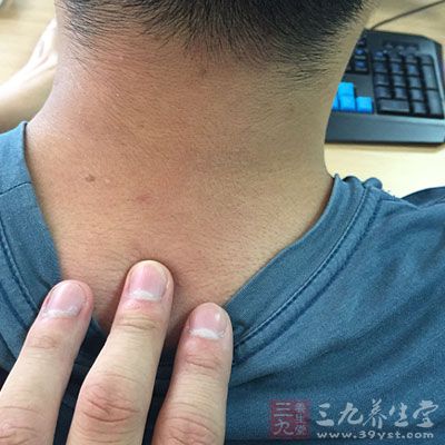 加强头颈部肌肉力量 加强头颈部肌肉力量