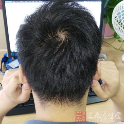 男人如何應(yīng)對電腦前的皮膚危機