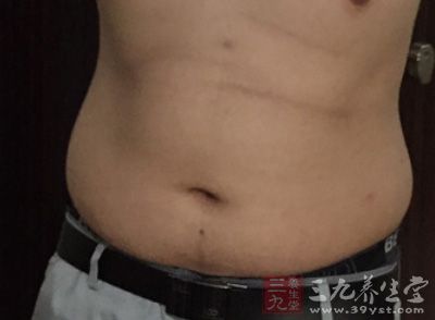 毒素导致大肠水肿，下半身血液循环减慢