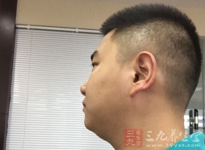 便秘可致内分泌失调 便秘可致内分泌失调