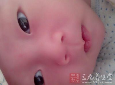 患儿多出现体重不增 患儿多出现体重不增