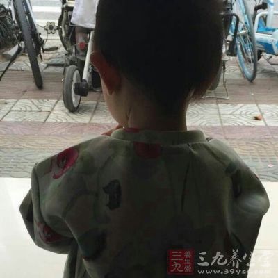 如何鉴别小儿过敏性咳嗽呢?