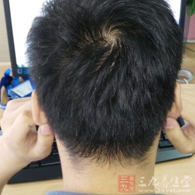 孕前视力检查的作用是什么