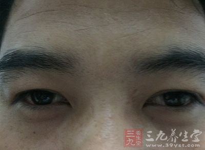 眼部护理 男人心灵之窗护理有妙招