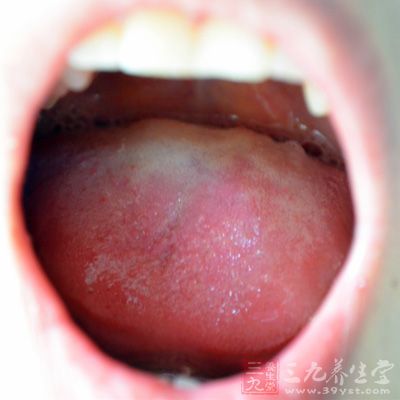 口干，口苦，口臭，舌苔发厚，牙龈红肿，这些都是肝火旺的症状