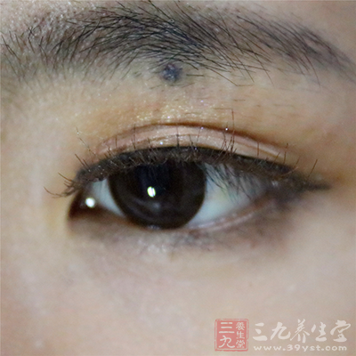 黑眼圈可能跟妇科疾病有关 黑眼圈可能跟妇科疾病有关