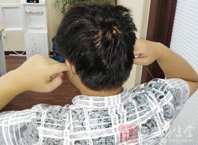 降低精子的活动能力 降低精子的活动能力