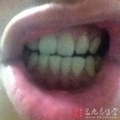 小诊所把三叉神经痛当牙痛治 女子3年拔掉满口