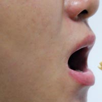 去除口臭有效的偏方 口臭应该怎么改善饮食