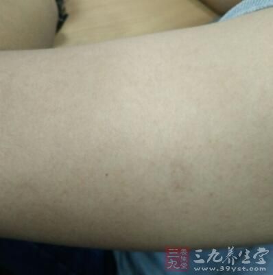 被晒过之后再涂防晒霜是不是就没有作用了？