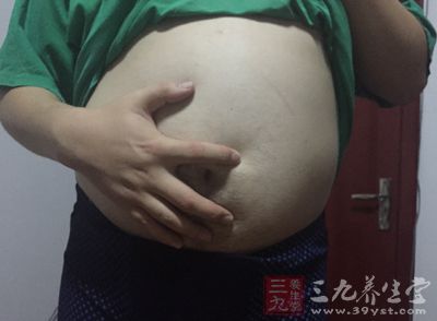 肥胖是身体发炎的关键推手 肥胖是身体发炎的关键推手