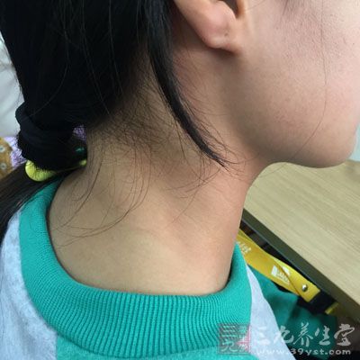 脖子是寒风容易侵袭的地方